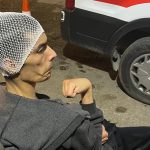 Gaziantep’te engelli bakım merkezinde şiddet: Gencin başına 6 dikiş atıldı