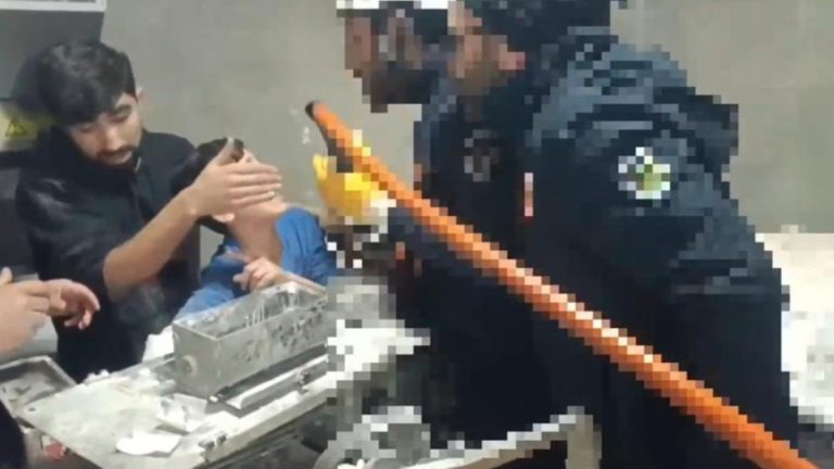 Şanlıurfa’da kolu hamur makinesine sıkışan çocuğu itfaiye kurtardı