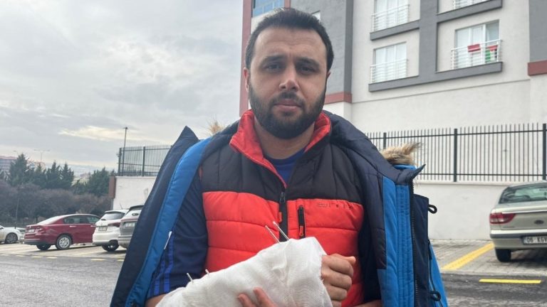 Ankara’da köpeklerin saldırısından kaçarken düştü: Kolunu kırdı