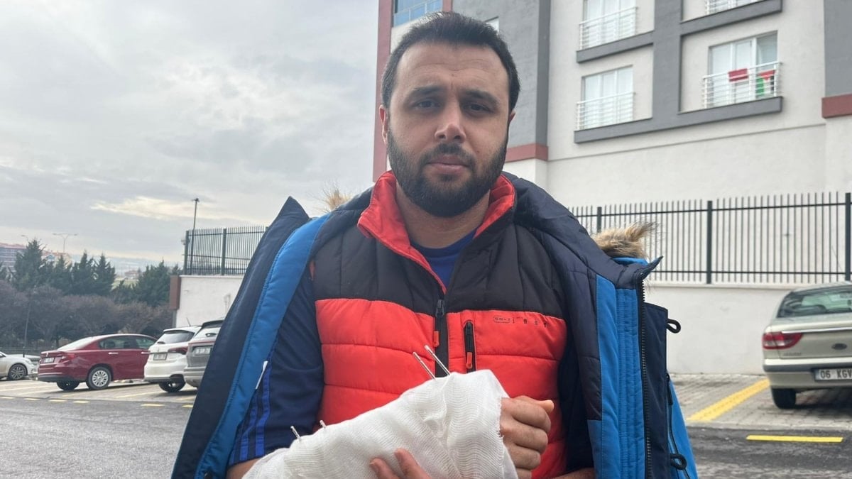 Ankara’da köpeklerin saldırısından kaçarken düştü: Kolunu kırdı