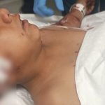 Ankara’da okul çıkışı sokak köpekleri saldırdı