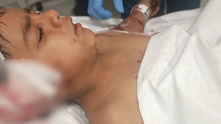 Ankara’da okul çıkışı sokak köpekleri saldırdı