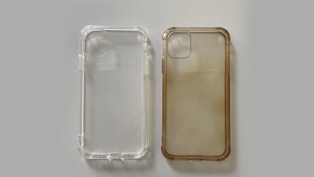 Bu yöntemi bilenler kılıf değiştirmiyor: Sarılığı anında yok ediyor