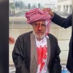 Şanlıurfa’da 72 yaşındaki adam sopalarla darbedildi