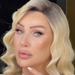 Seda Sayan yüzündeki şişliğin nedenini açıkladı