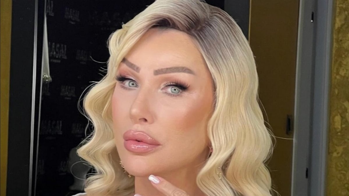 Seda Sayan yüzündeki şişliğin nedenini açıkladı