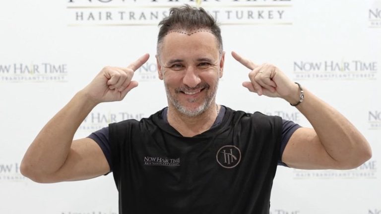 Vitor Pereira, saç ektirmek için İstanbul’a geldi