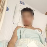 Antalya’da akran zorbalığına uğrayan çocuğun çenesi kırıldı