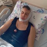 Eskişehir’de lise öğrencisi okul önünde darbedildi: Çenesi ve omuriliği kırıldı