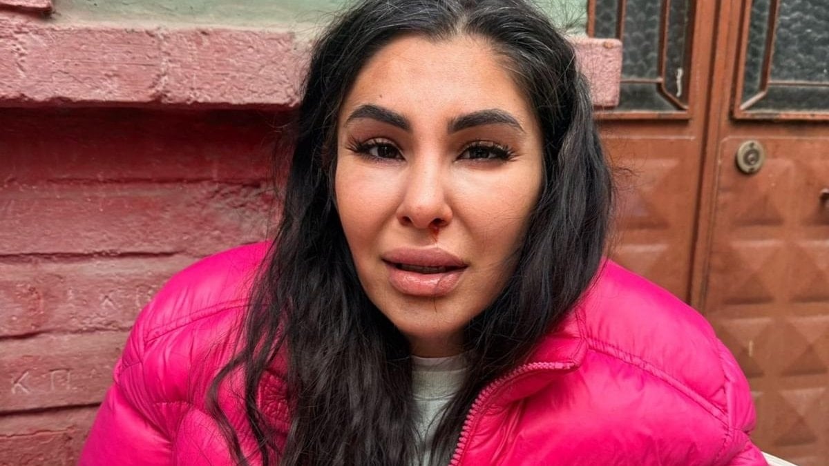 İstanbul’da erkek arkadaşından ayrılmak istedi, darbedildi