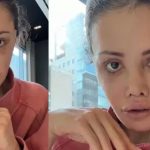 Yüz nakli yaptırmıştı! Didem Ceran kansere yakalandı