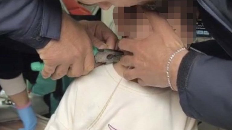 Adıyaman’da boynu plastik kelepçeyle sıkışan çocuk kurtarıldı