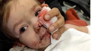 Ankara’da minik Efe’nin yaralandığı pitbull saldırısında istenen ceza belli oldu