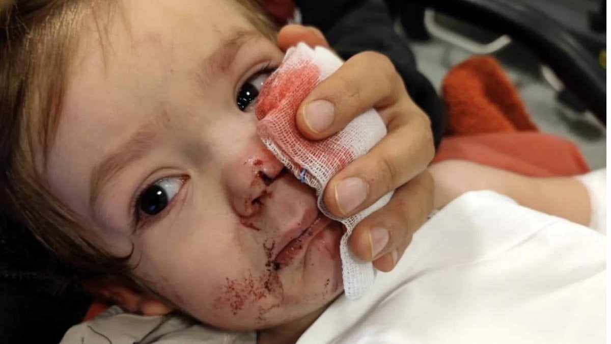 Ankara’da minik Efe’nin yaralandığı pitbull saldırısında istenen ceza belli oldu