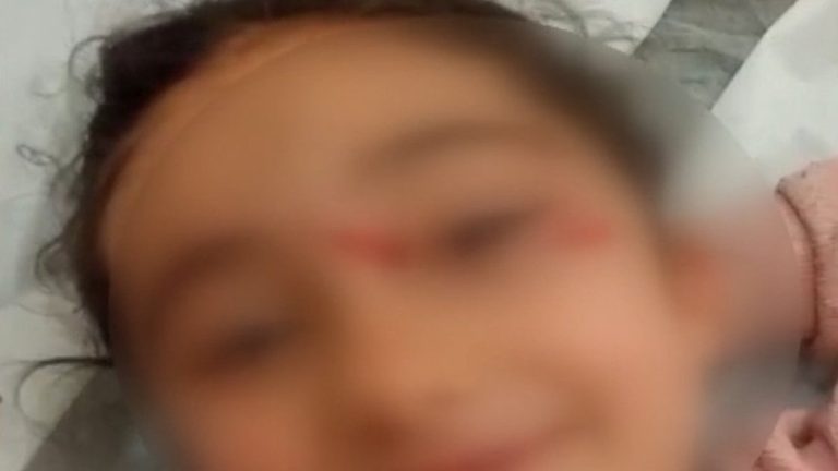 İstanbul’da 6 yaşındaki çocuğa köpekler saldırdı