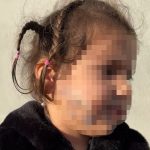 İzmir’de tasmasız köpek saldırısı: Küçük çocuk yüzünden ısırıldı