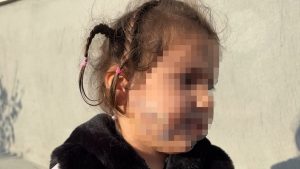 İzmir’de tasmasız köpek saldırısı: Küçük çocuk yüzünden ısırıldı