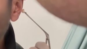 Kayseri’de şaşırtan yöntem: Uyuşturucuyu kulağında sakladı