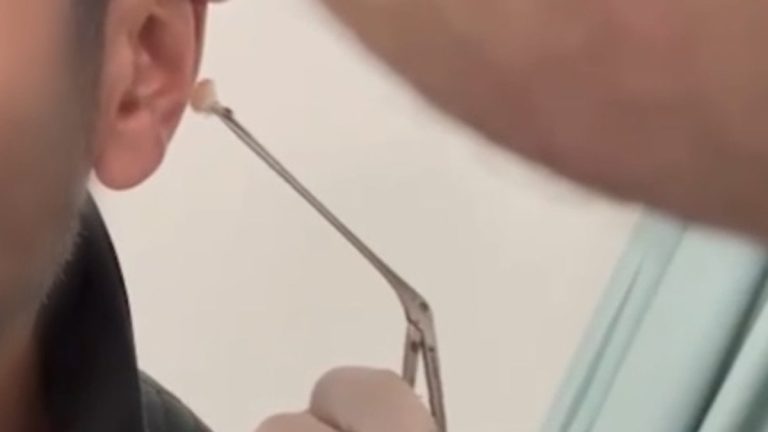 Kayseri’de şaşırtan yöntem: Uyuşturucuyu kulağında sakladı