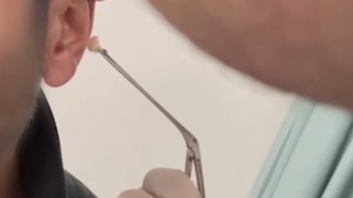 Kayseri’de şaşırtan yöntem: Uyuşturucuyu kulağında sakladı