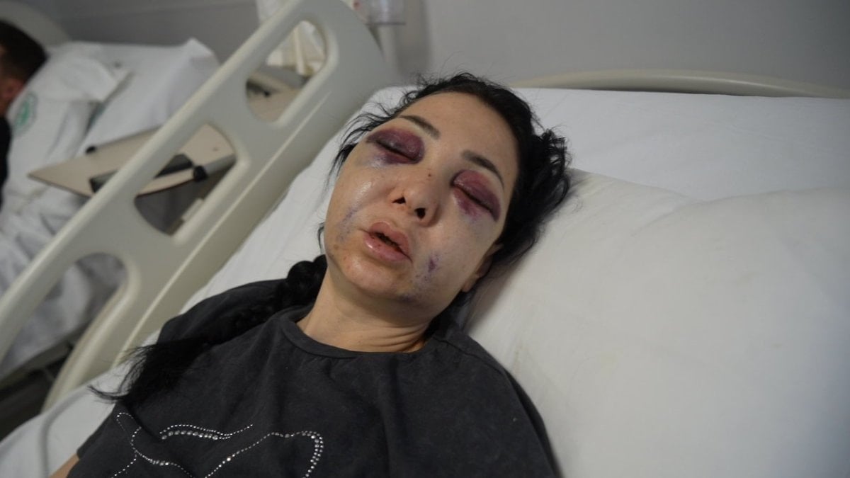 Kocaeli’de gittikleri kafede anne ve oğlu darbedildi