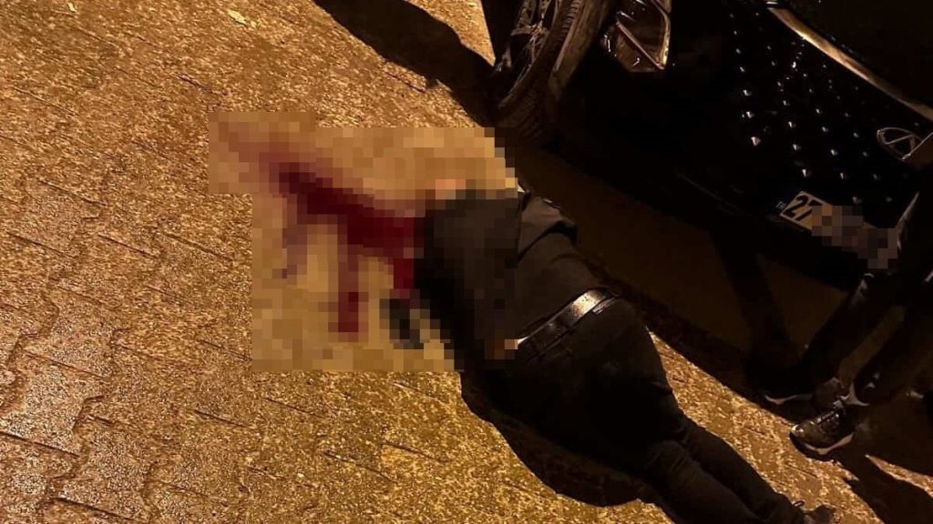 Şırnak’ta yürürken başından vuruldu