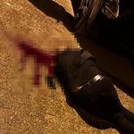 Şırnak’ta yürürken başından vuruldu