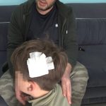 Yalova’daki komşu kavgasında bu kez 8 yaşındaki çocuğa taşlı saldırı