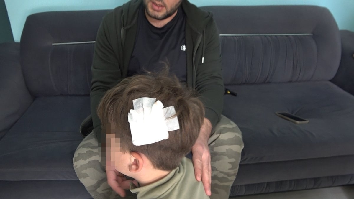 Yalova’daki komşu kavgasında bu kez 8 yaşındaki çocuğa taşlı saldırı