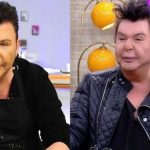 Yüzü deforme olmuştu! Kuşum Aydın’ın ameliyat oldu