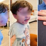 Bursa’da kreşe sağlam giren çocuk, akşam darbedilmiş halde çıktı