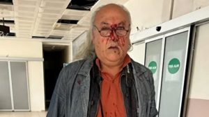 CHP’li Ayvalık Belediyesi’nin korumalarından gazeteci Yüksel Kalkan’a darp