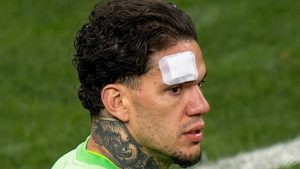 Ederson’a yabancı madde için açıklama