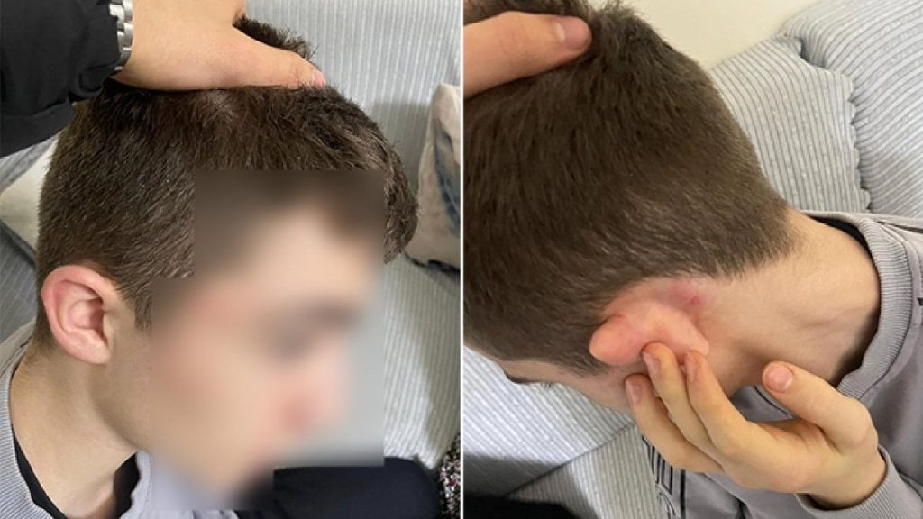 İstanbul’da hırsızlık yaptı sandılar: 14 yaşındaki çocuğu tekme tokat dövdüler