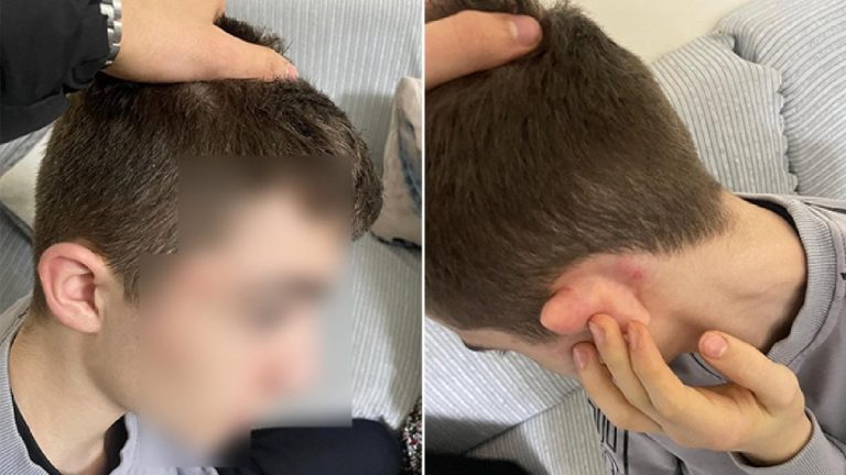 İstanbul’da hırsızlık yaptı sandılar: 14 yaşındaki çocuğu tekme tokat dövdüler