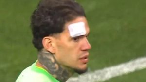 Kayserispor – Fenerbahçe maçında Ederson’a yabancı madde geldi