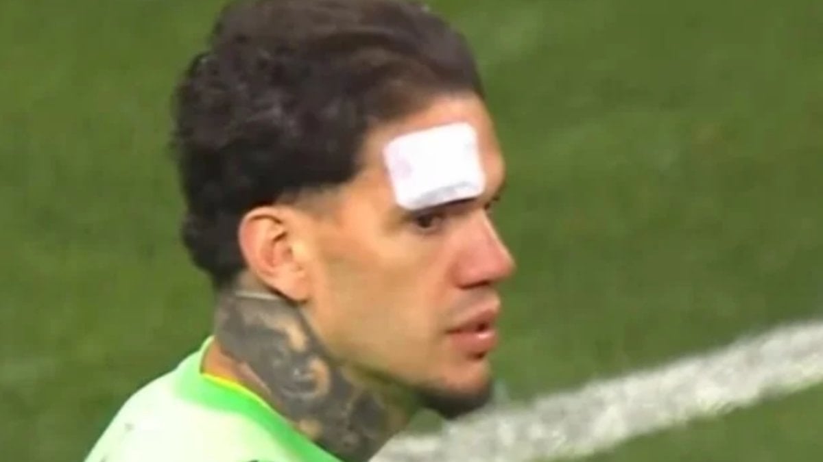 Kayserispor – Fenerbahçe maçında Ederson’a yabancı madde geldi