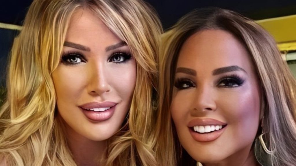 Safiye Soyman yine estetik yaptırdı! Yüzünü gerdirip gıdığını aldırdı