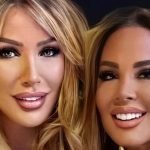 Safiye Soyman yine estetik yaptırdı! Yüzünü gerdirip gıdığını aldırdı