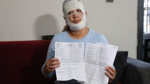 Adana’da güzelleşmek umuduyla işlem yaptırdı: Suratı yandı
