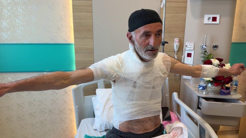 Erzurum’da arızayı tamir ederken üzerine dökülen sıcak su ile yaralandı
